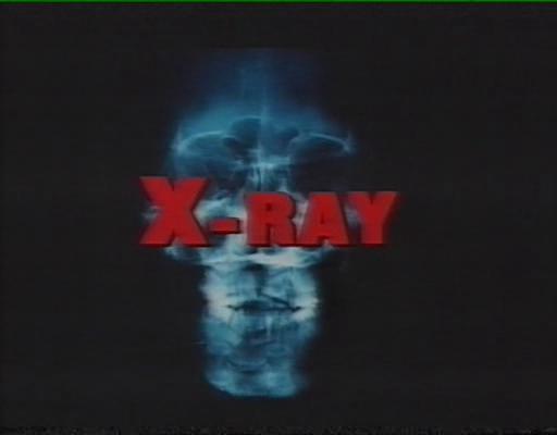 医院大屠杀 剧照7