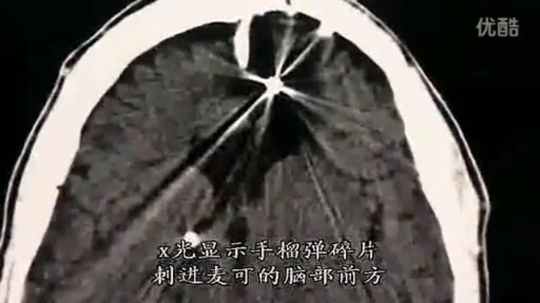 人脑漫游 剧照5