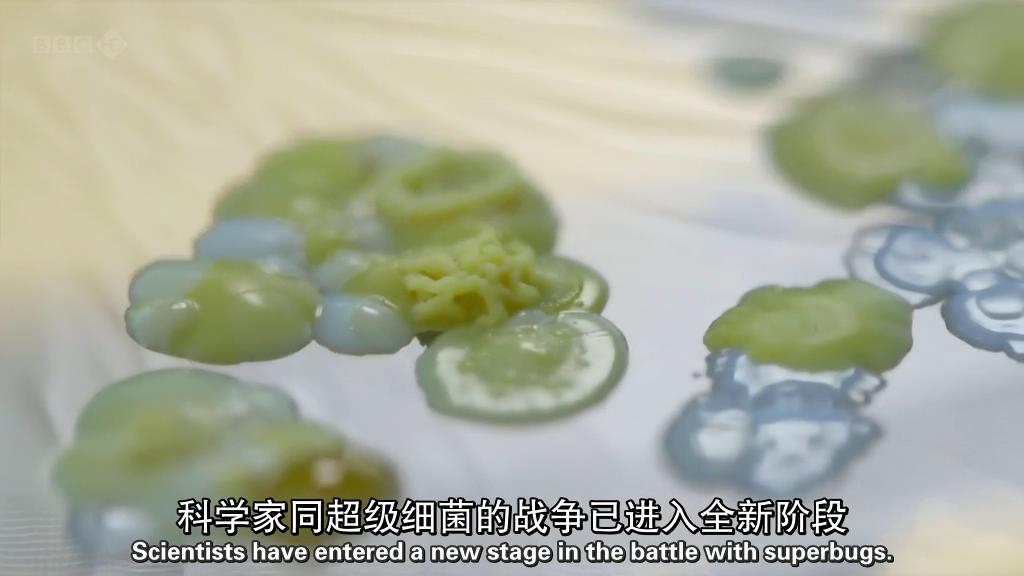 地平线系列:战胜超级病菌 剧照1