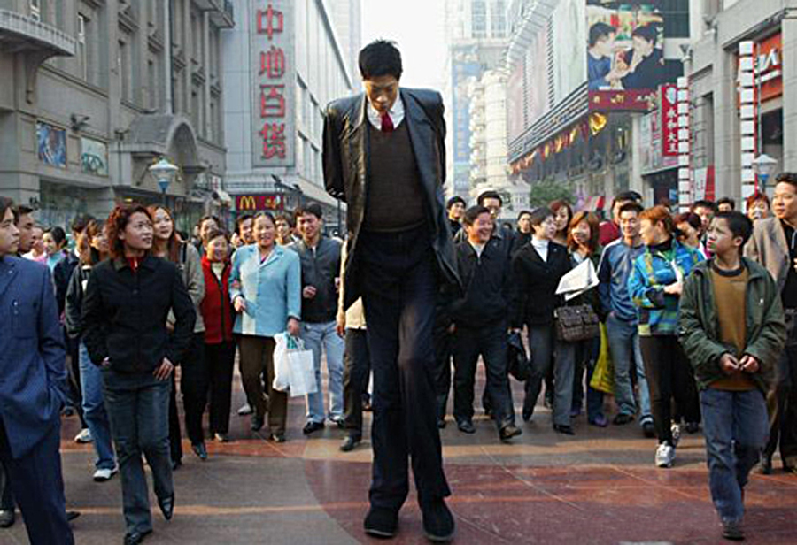 异于常人:巨人症 剧照8