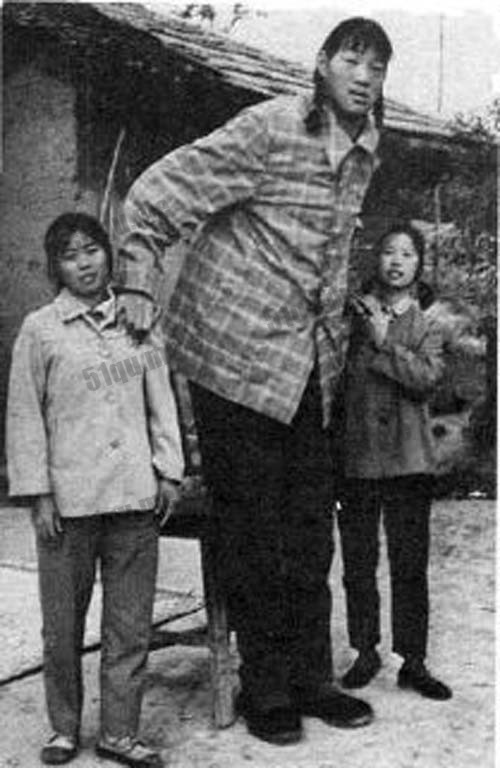 异于常人:巨人症 剧照10