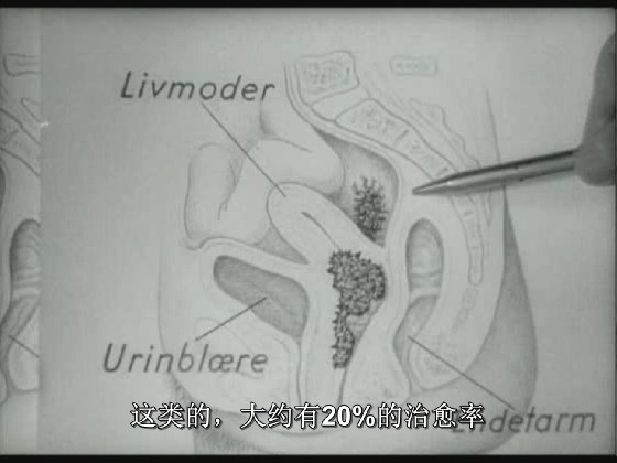 抗癌 剧照2