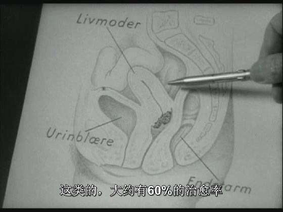 抗癌 剧照3